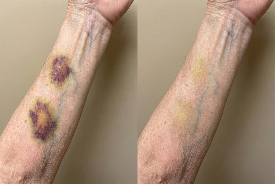 PRIGLED customer result image